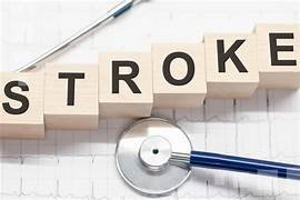 Hati-hati! Ini Adalah Alasan Mengapa Serangan Stroke Sering Terjadi di Pagi Hari.